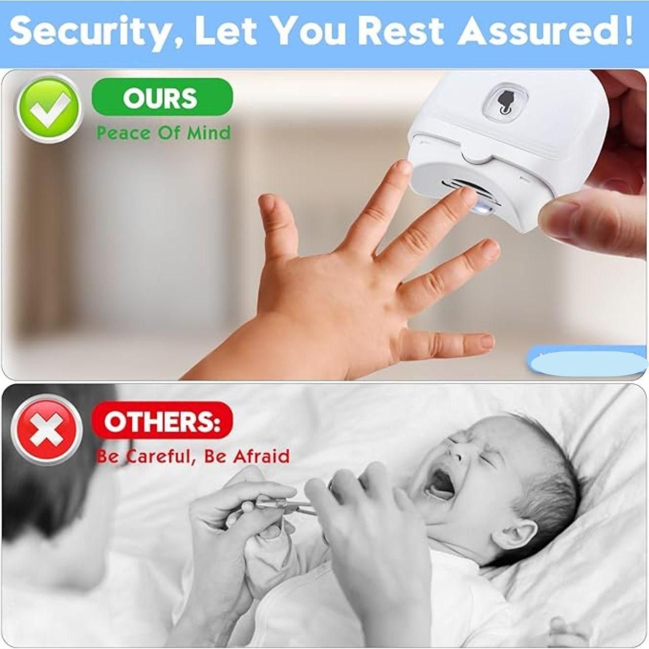 Electric Nail Trimmer – Safe, Painless & Rechargeable!