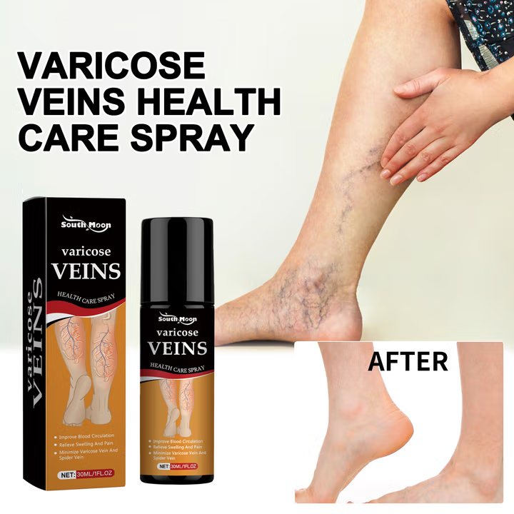 Turmeric Varicose Vein Relief Spray( BUY 1 GET 2 FREE💥 🎁 )