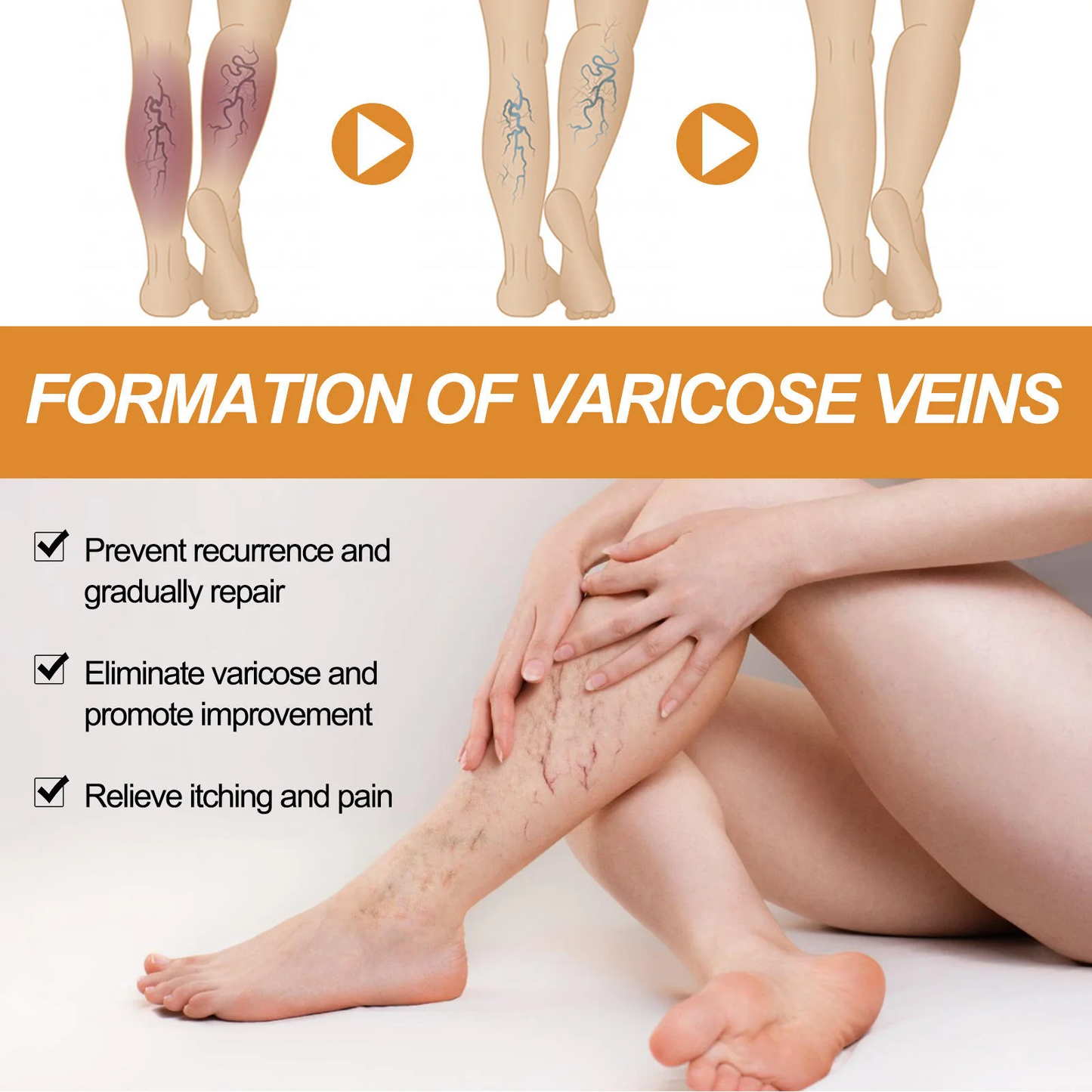 Turmeric Varicose Vein Relief Spray( BUY 1 GET 2 FREE💥 🎁 )
