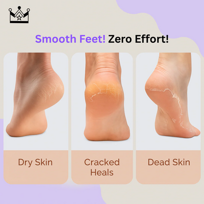 GlowStep - Callus Remover For Feet